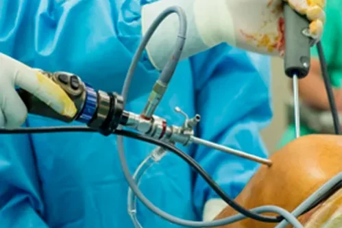 Artroscopia-y-Cirugía-Articular